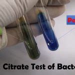 Principle Of Citrate Test Archives Universe84a