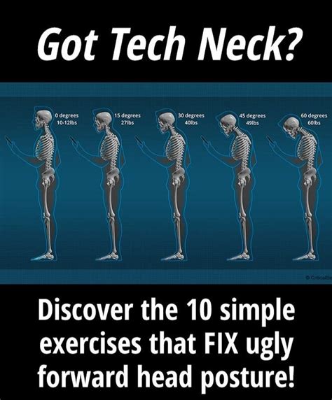 How To Correct Forward Head Posture Natural Neck Correction Home