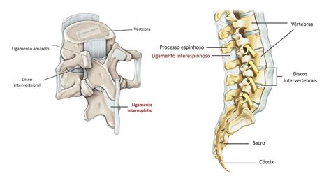 Edema Dos Ligamentos Interespinhosos