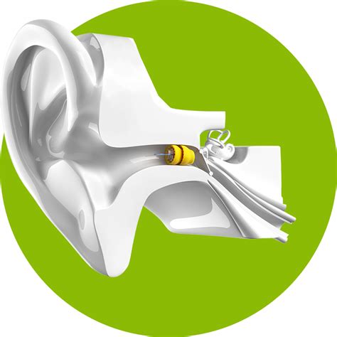 Lyric Hearing Aids Colorado Ear Care