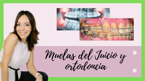 Quitar Muelas Del Juicio Para Poner Brackets Ortodoncia Extracci N De