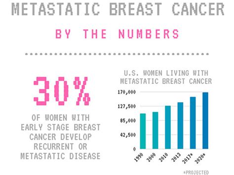 Metastatic Breast Cancer Treatment What Really Matters News Uab