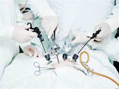 Pelvic Laparoscopy Purpose Procedure And Recovery