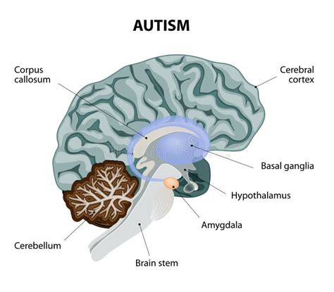 Autism Brain Structure