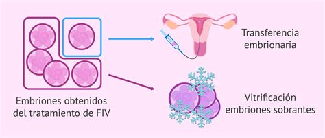 Vitrificaci N De Embriones Ginofiv