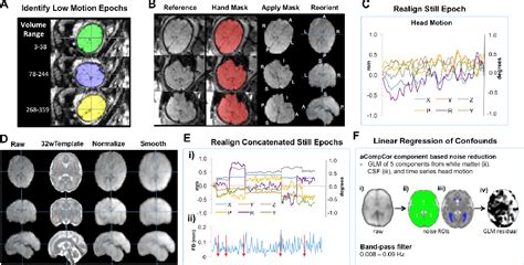 Figure 1 From Interpreting Age Effects Of Human Fetal Brain From