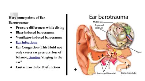 Ear barotrauma causes, symptoms and treatment | PPT