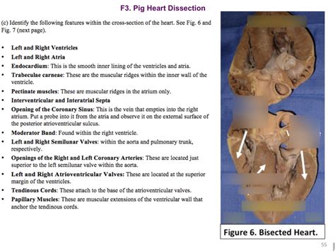 Pig Heart Dissection Diagram | Quizlet