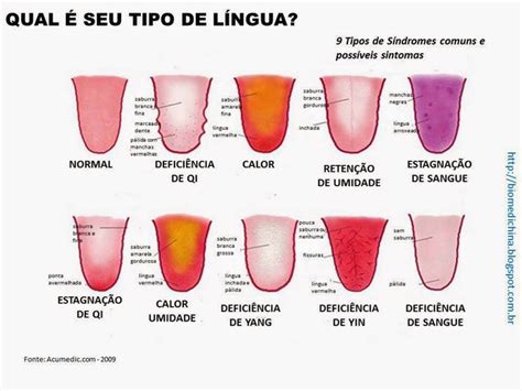 Lingua Com Mancha Vermelha - O que a língua diz sobre o nosso estado de saúde - greenMe.com.br