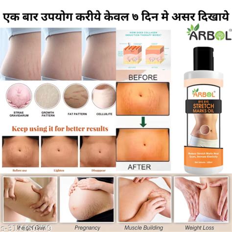 Arbol Present Repair Stretch Marks Removal Natural Heal Pregnancy