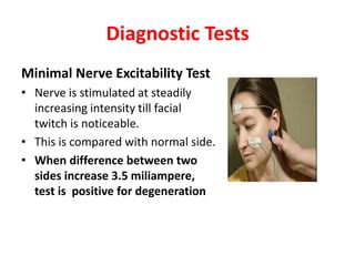 Facial Nerve Lesions PPT