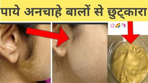 How To Remove Facial Hair At Home Naturally New Home Remedy To