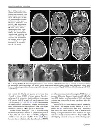 Central Nervous System Tuberculosis Pdf