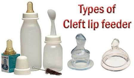 FREE CLEFT LIP AND PALATE SURGERY IN DELHI: TYPE OF FEEDING BOTTLE FOR ...