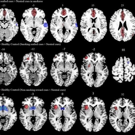 Brain Regions Showed Significant Differences In Response To