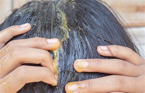 16 Effective Hair Masks To Treat Hair Loss