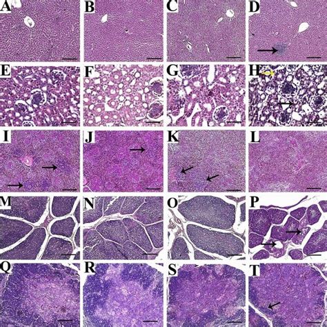 Representative Photomicrographs For Liver Ad Kidney Eh Spleen