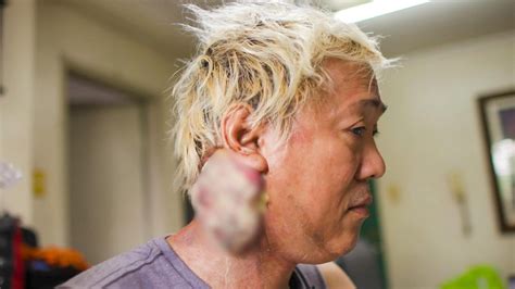 ATE GAY MAY STAGE 4 CANCER