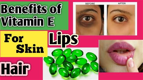 Vitamin E Capsule Review Benefit And Use Of Vitamin E Capsules YouTube