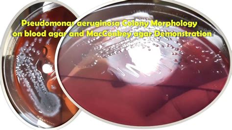 Pseudomonas aeruginosa colony morphology on blood agar and Macconkey ...