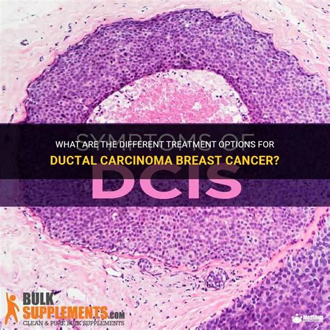 What Are The Different Treatment Options For Ductal Carcinoma Breast