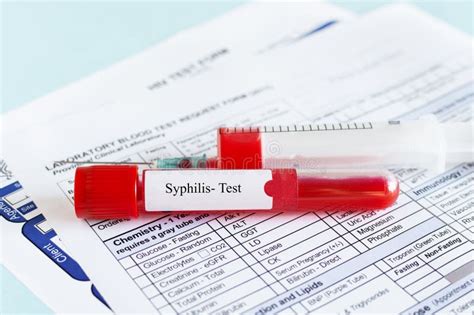 SYPHILIS Blood For Syphilis Test Syphilis Printed Diagnosis Stock