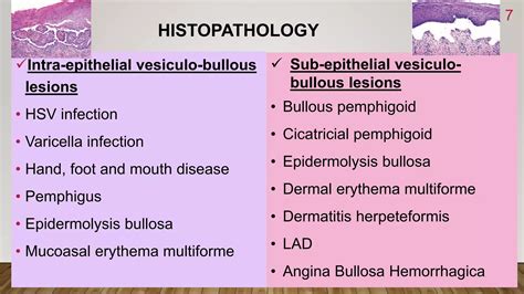 Vesiculo Bullous Lesions Of Oral Cavity Ppt