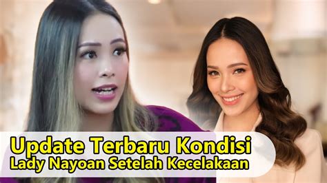 Kabar Terkini Lady Nayoan Pasca Insiden Kecelakaan Dengan Rendy