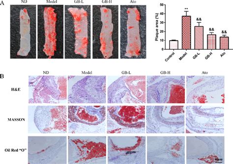 Gb Reduced Atherosclerotic Lesions In Hfd Induced Apoe Mice N