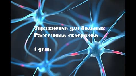 Упражнения для больных рассеянным склерозом 1 день - YouTube