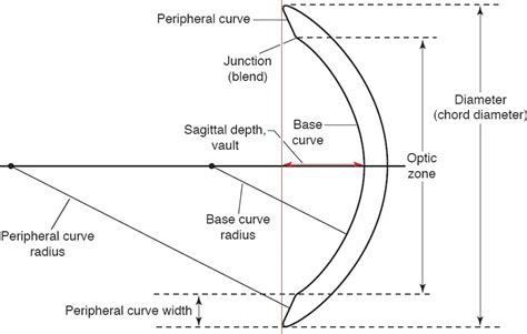 Contact Lens Base Curve What Is How Importance Is It? —, 47% OFF