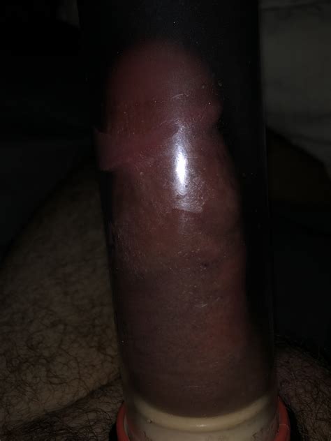 Only Anal Page XNXX Adult Forum