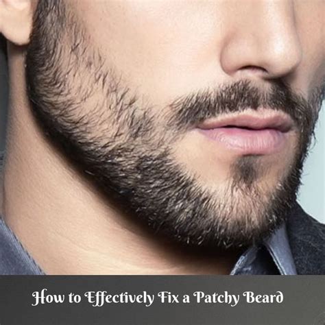 How To Effectively Fix A Patchy Beard Bald Spots Effective