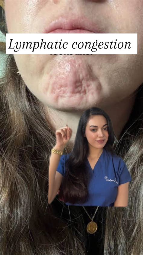 Dr.mehss | Leptin resistance is caused by chronic overeating, high-fat