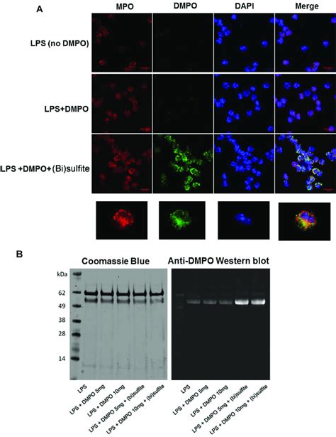 Bi Sulfite Induces Protein Radical Formation In Balf Neutrophils Of