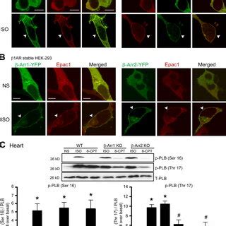 ISO induced the translocation of CaMKII δC and Epac1 to plasma membrane