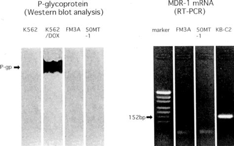 Expression Of P Glycoprotein And Mdr Mrna In Fm A Cells And