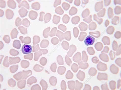 Nucleated Red Blood Cells LM Stock Image C043 5153 Science Photo