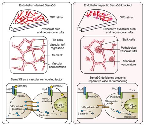 Endothelium Derived Semaphorin G Attenuates Ischemic Retinopathy By