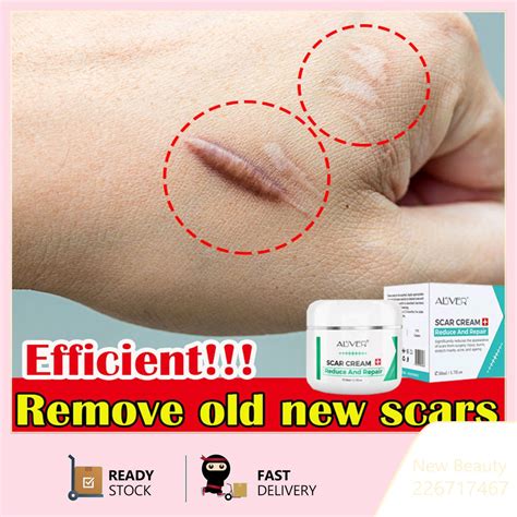 ALIVER Scar Cream 50ML Effectively Repair Surgical Scars Burns