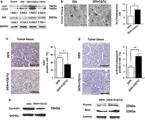 Autophagy Inhibition Suppressed Tumor Cell Proliferation And Promoted