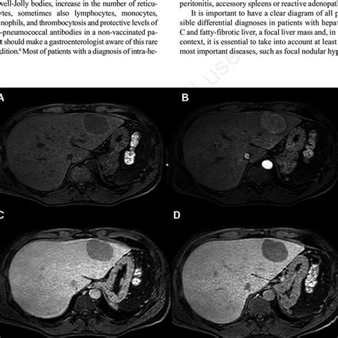 Magnetic Resonance Findings Of The Hepatic Focal Lesion A Tse T