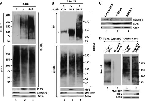 Smurf Ubiquitinates Klf A Ubiquitination Of Overexpressed Klf With