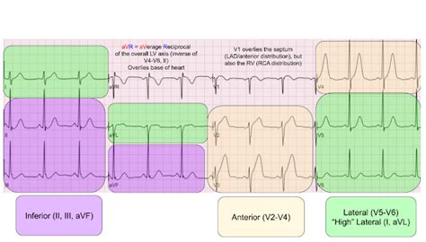 Ecg Leads And Myocardial Territories