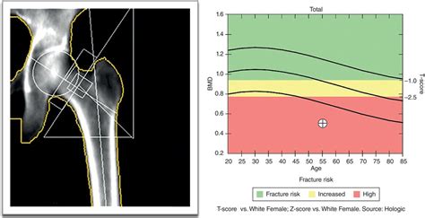 Bone Diseases | Pocket Dentistry