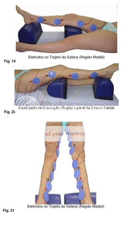 Sosfisio O Blog Da Sa De Physiotonus Slim Corrente Russa