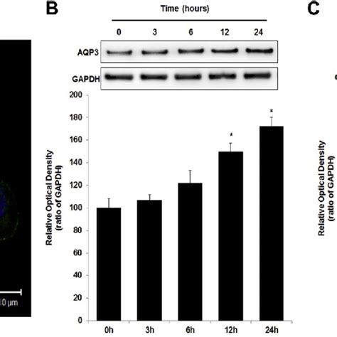 Effects Of All Trans Retinoic Acid On AQP3 Expression Analyzed By