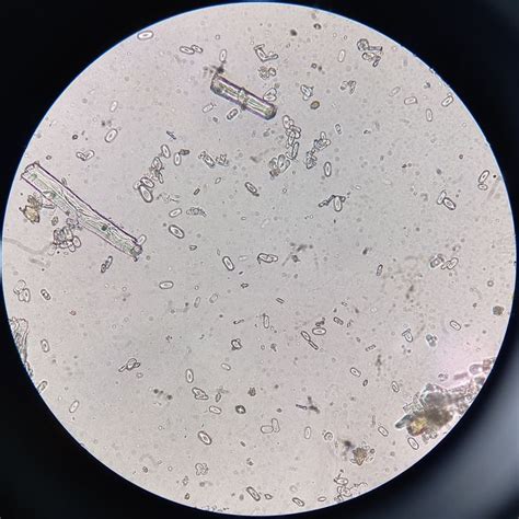 Urine under the Microscope | Study motivation, Urinal, Tableware