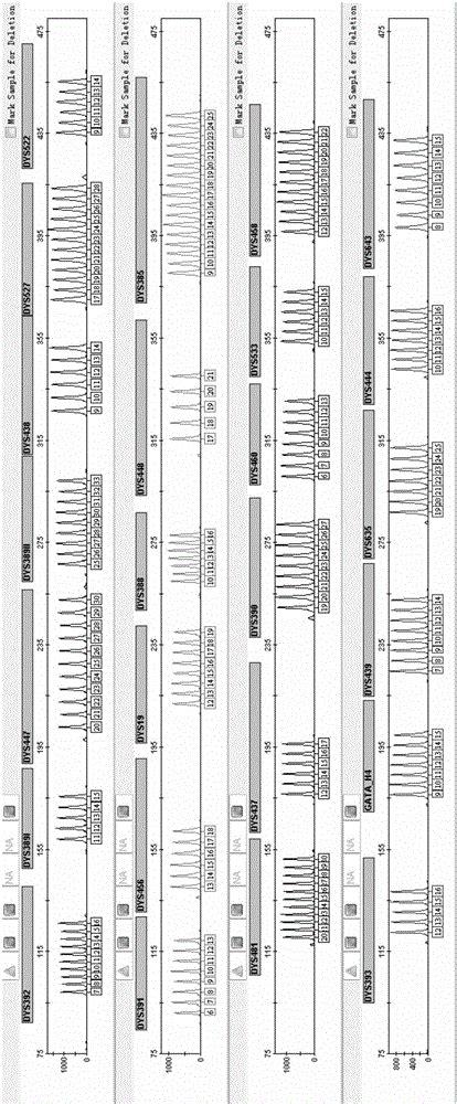 Fluorescent Mark Multi Amplification Kit Of 27 STR Loci Of Human Y