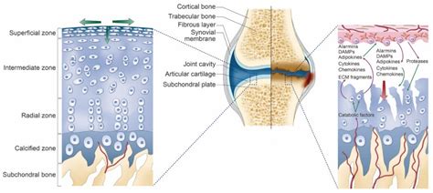 Ijms Free Full Text Recent Updates Of Diagnosis Pathophysiology